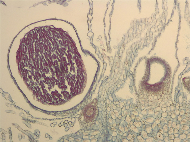 Liverwort Sporophyte Slides - Liverwort Sporophyte 04 100X